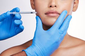 dermal-fillers-realsimple-GettyImages-1550223709